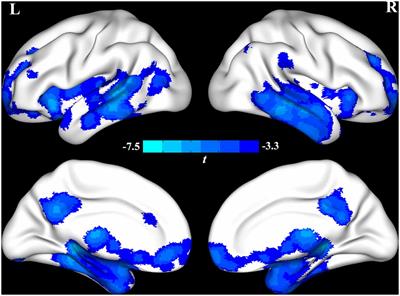 Frontiers | Differences in Cerebral Structure Associated With 